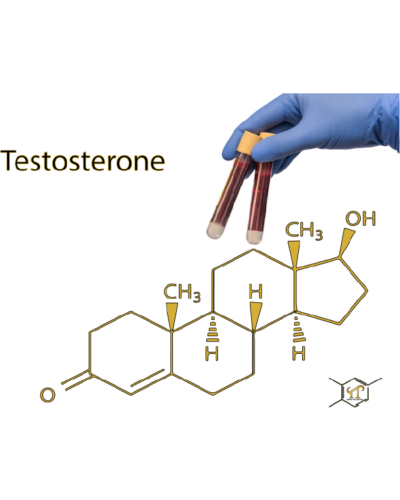 Testosterone Free & Total,Direct, LC/MS-MS